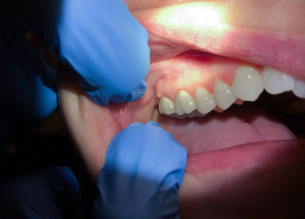 Best Weekend Emergency Dentist in Somerville, MA